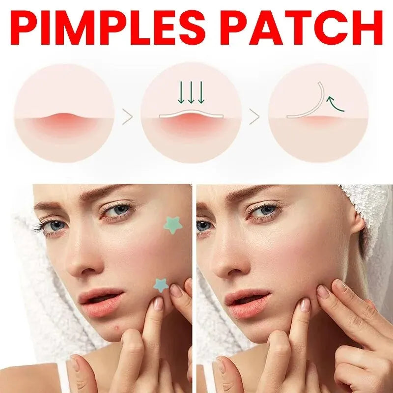 Acne Patch Repair: Fade Blemishes & Pimple Marks